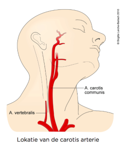 De carotis arterie